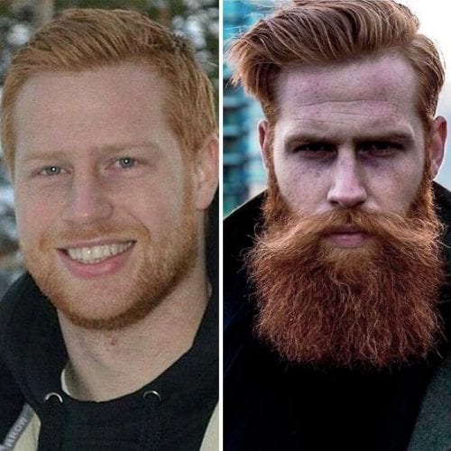 Barba mudou a vida desse homem (7)